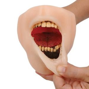 흡연으로인한 치아부식모형 MR DIP LIP