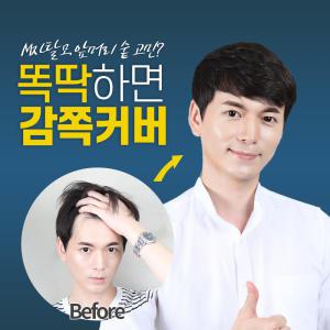 남자앞머리가발 / M자커버 / 인모부분가발 5종