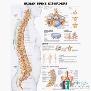 인체해부도 3D차트 병원액자 9970B 척추질병 54X74cm 액자옵션 척추차트 척추질병차트