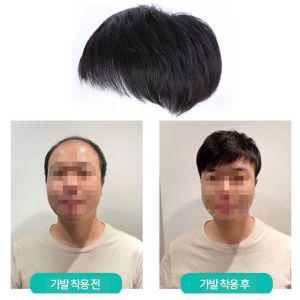 남자가발 정수리 커버 풍성한 앞머리 패션 미용 장발