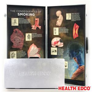 HEALTH EDCO USA 3D입체모형 79601 흡연의결과 흡연예방교육