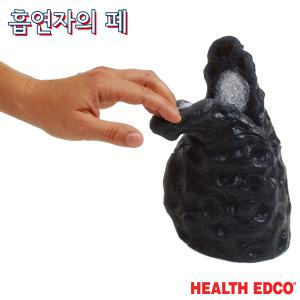 HEALTH EDCO USA 흡연자 폐모형 26813 흡연예방교육