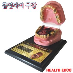 HEALTH EDCO USA 흡연예방교육 79152 구강모형 금연교육_