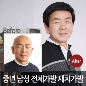 중년 남자 전체 통가발 국내자체 생산