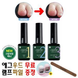 내향성 파고드는 내성 발톱 젤 자가 치료 교정 연화제 뇌성발톱 관리 도구