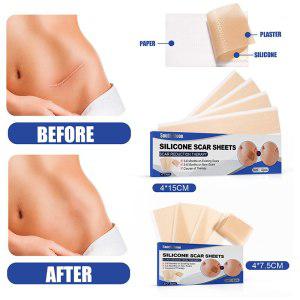 NEW  ALIVER Silicone Gel Strips Patch Silicone Scar Sheets Reusable Scar Removal Patch Remove Trauma