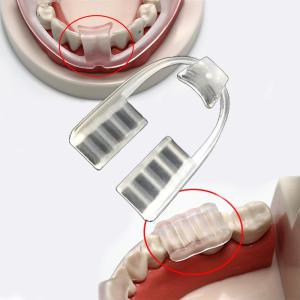 이갈이 방지 치료 보톡스 잘때 어린이 이악물기 수면 마우스 피스 가드 치아보호 이가리 h