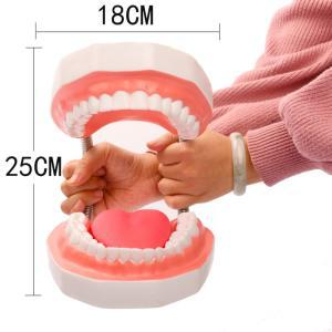 치아 모형 대형 치과 모델 해부 충치 연습 교구 구강