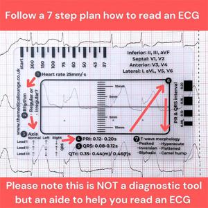 Ecg 관찰용 휴대용 투명 7 단계 눈금자 7 단계 체중계, 눈금자 측정 도구, Ecg 통역용 눈금자