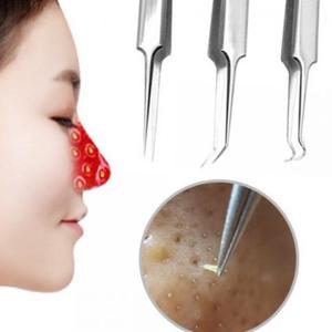 짜기 피지제거기 여드름짜기 코 얼굴 블랙헤드 압출 바늘