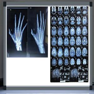 치과 병원 Xray 판독 램프 CT 고주파 센서 케이스 감마 다크룸 휴대용 암실 상자 엑스