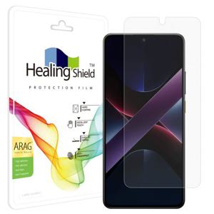 샤오미 포코 X7 프로 ARAG 고화질저반사 액정필름1매