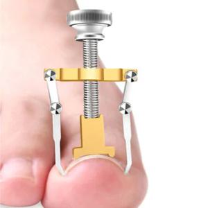 내성발톱교정기