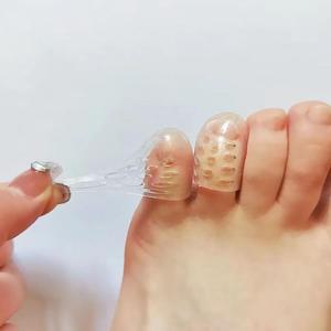 [HYIJQYWV_4B]발가락보호캡 통기성골무 통기성 발톱 보호
