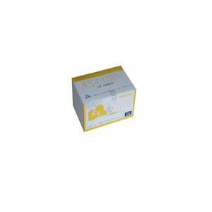 덕우 카테타 정맥카테타 IV-catheter 24g 3/4
