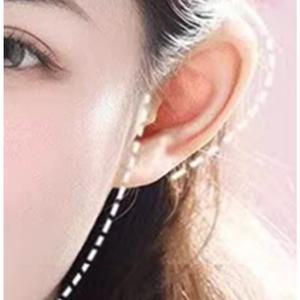 요정귀테이프 눌린귀 누운귀테이프 나비 귀세우는 귀성형