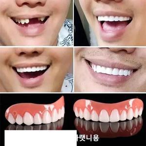 임시치아/가짜이빨 미백 틀니(4세대 미백 틀니)