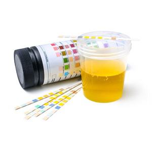 DFI 소변검사지 검사스틱 단백뇨혈뇨 당뇨케톤체 4종10종(100매)