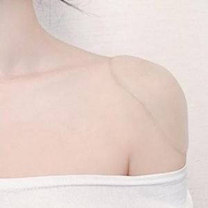 [피커]실리콘 어깨 뽕