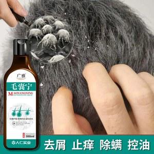 샴푸 비듬 방지 가려움증 샴푸 중국어 허브 헤어 케어 진드기 모낭염 지루성 드라이 샴푸