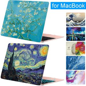 Macbook Air M4 13 M1 Pro 13 14 M3 15 16 M2 Mac 하드 쉘 Funda Retina A3240 A3113 A3241 A2992 노트북 액세서리 커버