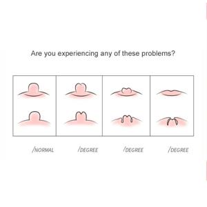 휴대용 여성 젖꼭지 교정기, 흡입 펌프, 흡입 풀러, 젖꼭지 마사지 교정기, 엄마 건강 관리