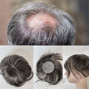 남성용 옆머리 또는 뒷머리 패치, 남성용 헤어피스, 머리 위 대머리 커버, 얇은 피부, 부분 가발 패치, 8cm x 8cm