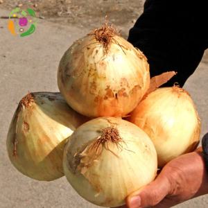 대아프레시 야채 아저씨네 아삭 싱싱 햇양파 특대사이즈 15kg 25년 수확한 햇양파