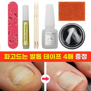 파고드는 발톱 케어 팁 테이프 세트