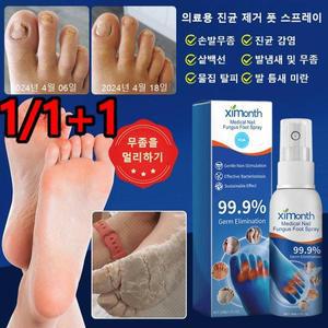 의료용 진균 제거 풋 스프레이 발냄새 발 가려움 물집 탈피 [해외]