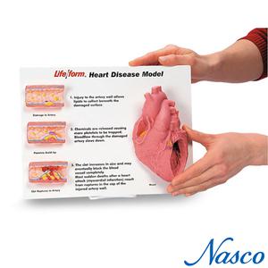 NASCO USA 실제크기 심장모형 WA20292 심장혈관질병모형