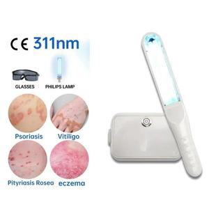 UVB 광선 요법 백반증 엑시머 램프, 건선, 습진, 장미 반점 치료