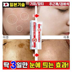 [일본피부과 전용] 2/2+2기미크림 기미 잡티 주근깨 검버섯 제거 크림 멜라토닝 멜라논 들림 얼굴 색소침착 착색 화이트닝 포장