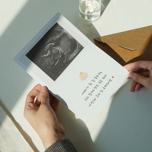 알티피아 임밍 서프라이즈 아웃 카드 이벤트 임밍아웃카드 임밍아웃이벤트 임밍아웃복권