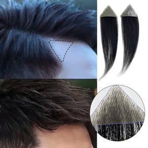 남성용 인모 교체 패치, 모발 없는 우발적인 화상, 15cm 헤어라인 손실 스트레이트 테이프, 교체용 토피, 1 쌍