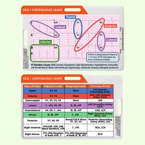 TEMU 빠른 해석을 위한 1개 ECG STEMI 분석 배지 카드 - 전면 및 후면 인쇄, 가로 및 세로 레이아웃, 아크릴 재질, 영어 텍스트, 의료 전문가에게 적합한 심장 사건 참조 | 전문적인 의료 카드 | 교육 도구