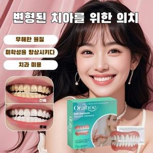 웃음 미관 향상 편안한 틀니 의치 완벽한미소틀니세트 치과 용품 컴포트 소재0704-05