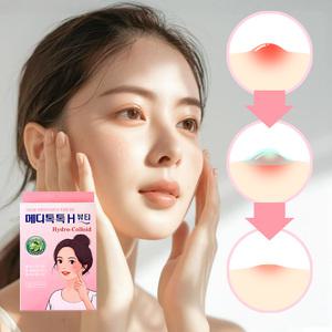 의약외품 약국전용 메디톡톡 여드름패치 42매입 지퍼백보관형 트러블 짜기 전후 진정