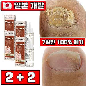 [7일만 100% 제거] 손발톱 앰플 영양제 손톱 발톱 강화 영양제 네일 케어