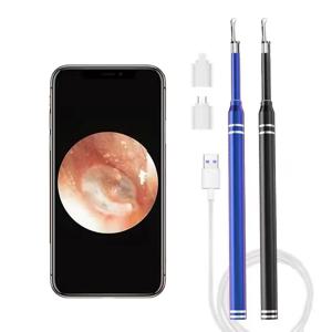 스마트 귀 클리너 내시경, 3-in-1 귀 검이경, 귀지 제거제 피커, 2 귀 스쿠프 지지대, 안드로이드 PC C타입, 5.5mm