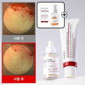 3일 기미 19% 개선 잡티 이별 톤업 미백 크림 / 비타민C 왕 아세로라 잡티기미 케어 크림 50ml