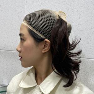 오픈형 머리고정 고급 스킨 트렌드 가발망 (WFGHKX8)