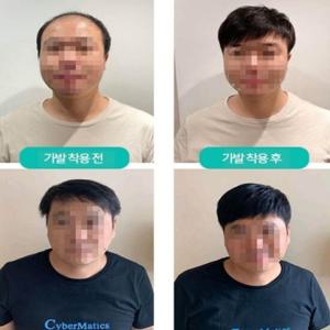 남성용 자연스러운 부분가발 부족한 머리숱 (WFGFBJ2)