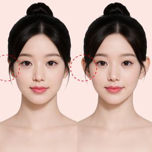 누운귀 테이프 60P 요정 엘프 귀 교정 세우는 필러 스티커 뒤 리프팅 성형 뷰티 미용