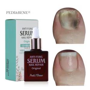 페디베네 안티펑 네일 리페어 세럼 오리지날 10ml 문제성발톱 성장촉진