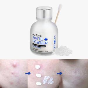 AC퓨어화이트파우더 / 문제성피부/레드스팟/트러블 집중케어/화농성/청소년화장품