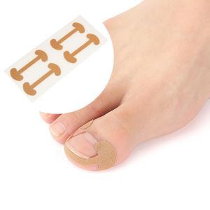 발톱 케어 테이프 보호 밴드 시트 4p내성자가치료 자가 교정기 내향성 파고드는