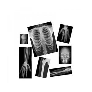 사람 X-Ray 사진세트