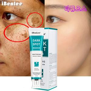 피부 화이트닝 톤업 크림 다크 스팟 안티 반점 제거 연고 흑반 색소 침착 멜라닌 크림
