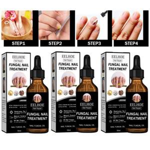 펑거스 세럼 대용량50ML 톱 문제성 손 발톱 영양제 발톱연화 티류으스
